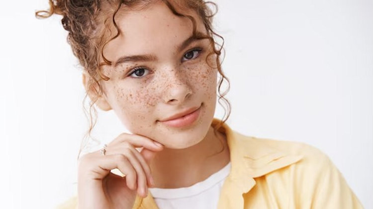 girl with freckles